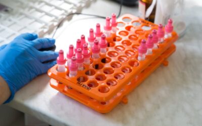 Cómo las bandejas termoformadas mejoran la eficiencia en la cadena de suministro