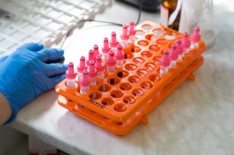 Bandejas termoformadas y eficiencia en la cadena de suministro